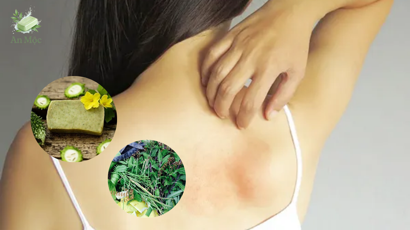 Nổi sảy