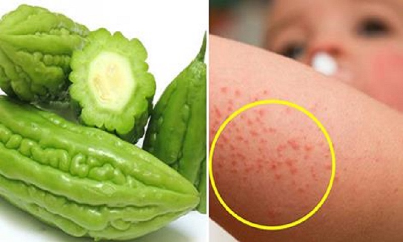 cách điều trị nổi sảy